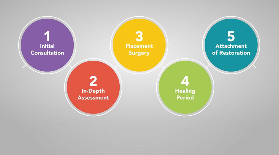 Dental Implant Process