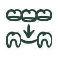 Dental Bridges